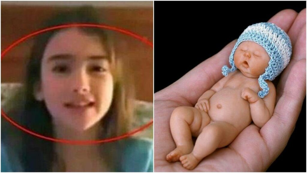 Inilah Amelia Taylor Bayi Terkecil Di Dunia Saking Kecilnya Muat Dalam Cangkang Telur Ayam