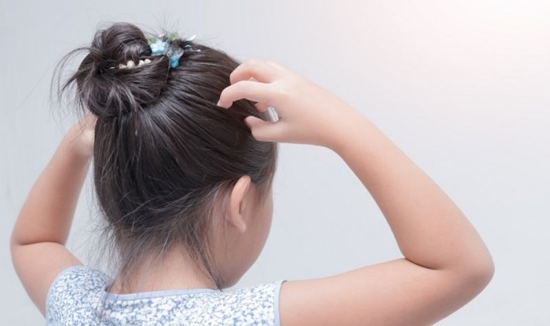 Cara Menghilangkan Kutu pada Rambut Anak